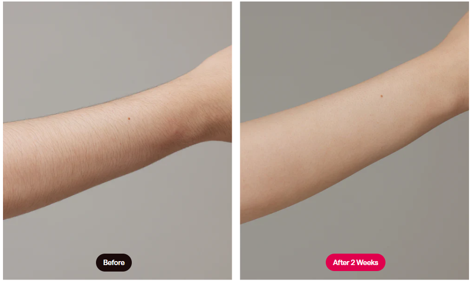 Ulike 10 Results on Arms